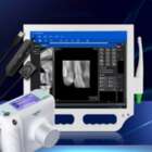 Carry Стоматологічний рентген апарат NaviStom