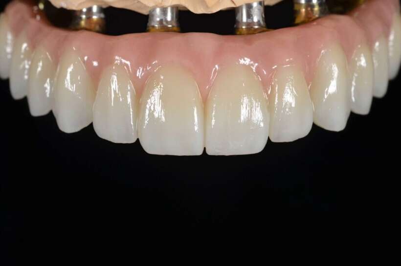 3D SMAIL LAB цифрова лабораторія .Цирконій преміум якості 1500 3D SMAIL LAB цифрова лабораторія .Цирконій преміум якості 1500 NaviStom