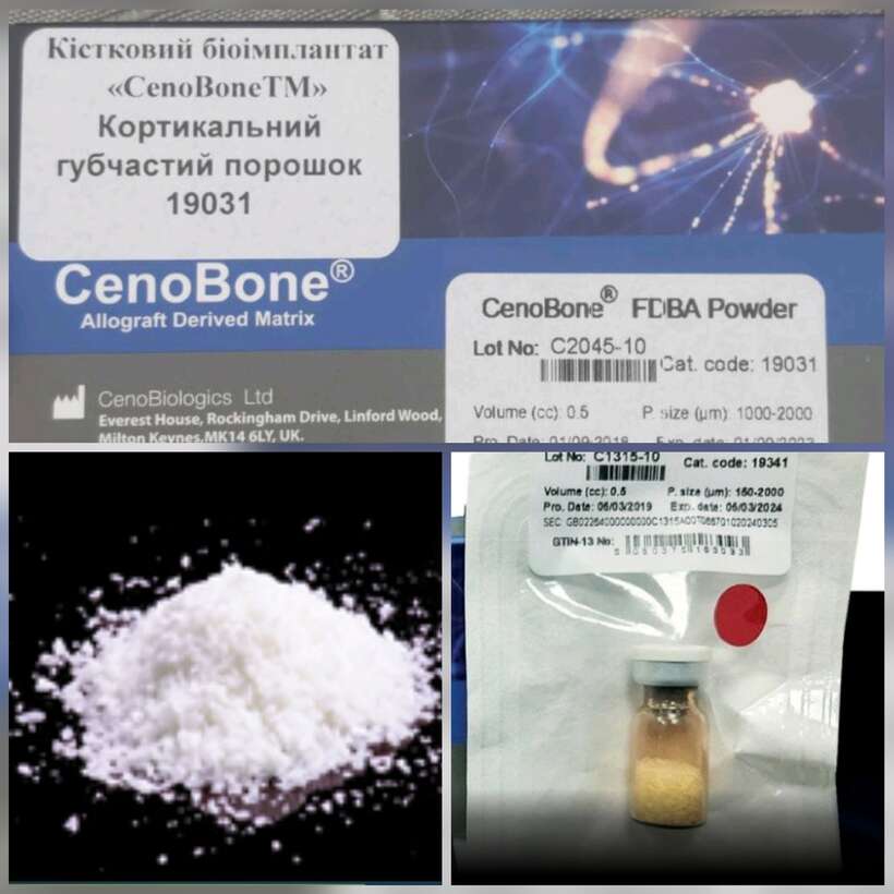 Алокість, кістковий матеріал NaviStom