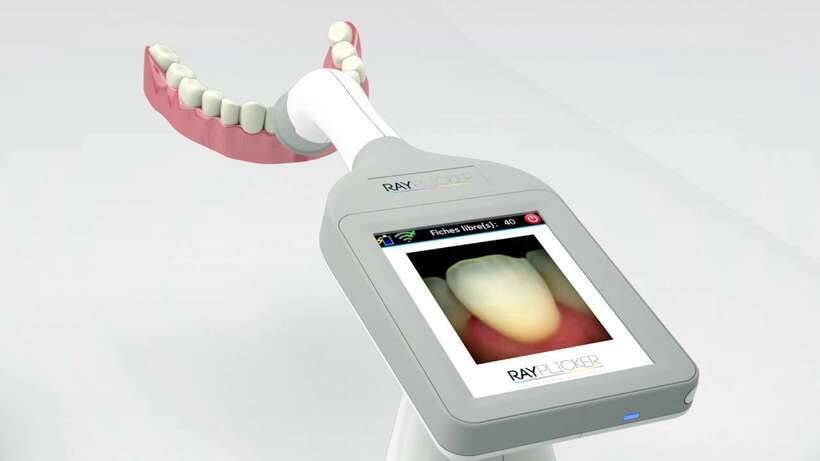 Цифровий індикатор зубного відтінка BOREA Rayplicker NaviStom