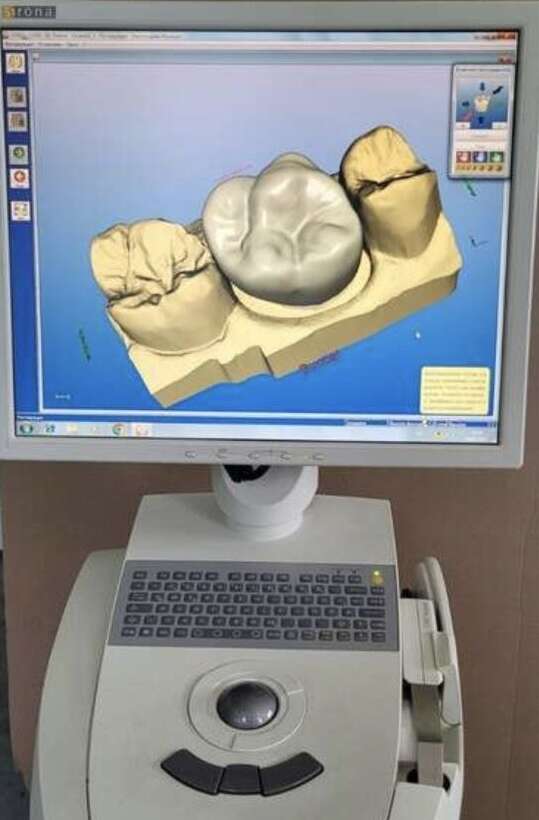 CEREC AC bluecam та шліфувальний блок CEREC3 Sirona NaviStom