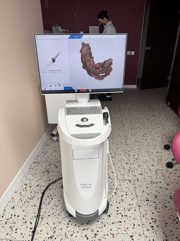 CEREC AC Connect – інтраоральний 3D сканер NaviStom