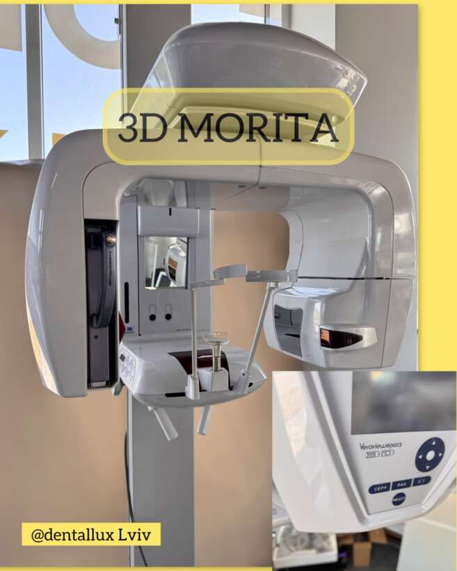 ДЕНТАЛЬНИЙ ТОМОГРАФ MORITA 3D Зроблені лише 700 КАТЕ! 4*8 рамка 4 зуба з верху 4 знизу NaviStom