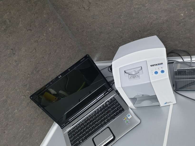 DURR Dental Vista Scan NaviStom