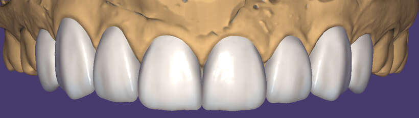 Встановлення Exocad 3.1, Exocad 3.2 8820, 9036, 3shape, B4D,Real Guide 5.2 AI Встановлення Exocad 3.1, Exocad 3.2 8820, 9036, 3shape, B4D,Real Guide 5.2 AI NaviStom