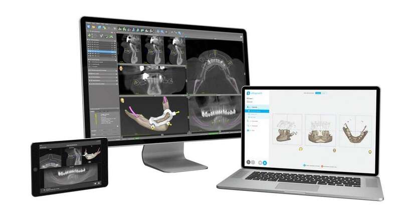 Exocad 3.2 Elefsina 3shape 2024 real Guide 5.4 Exocad 3.2 Elefsina 3shape 2024 real Guide 5.4 NaviStom