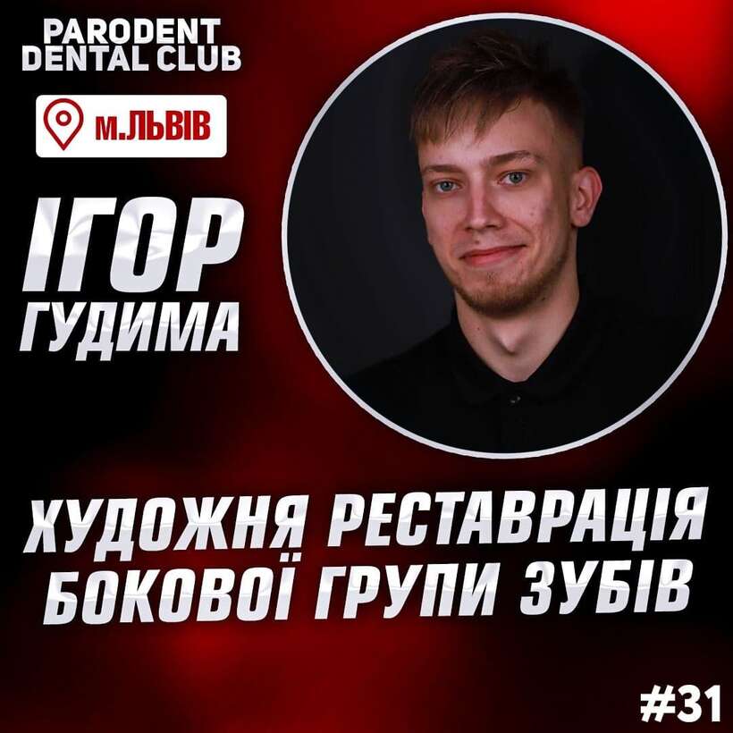 Художня реставрація бокової групи зубів Художня реставрація бокової групи зубів NaviStom