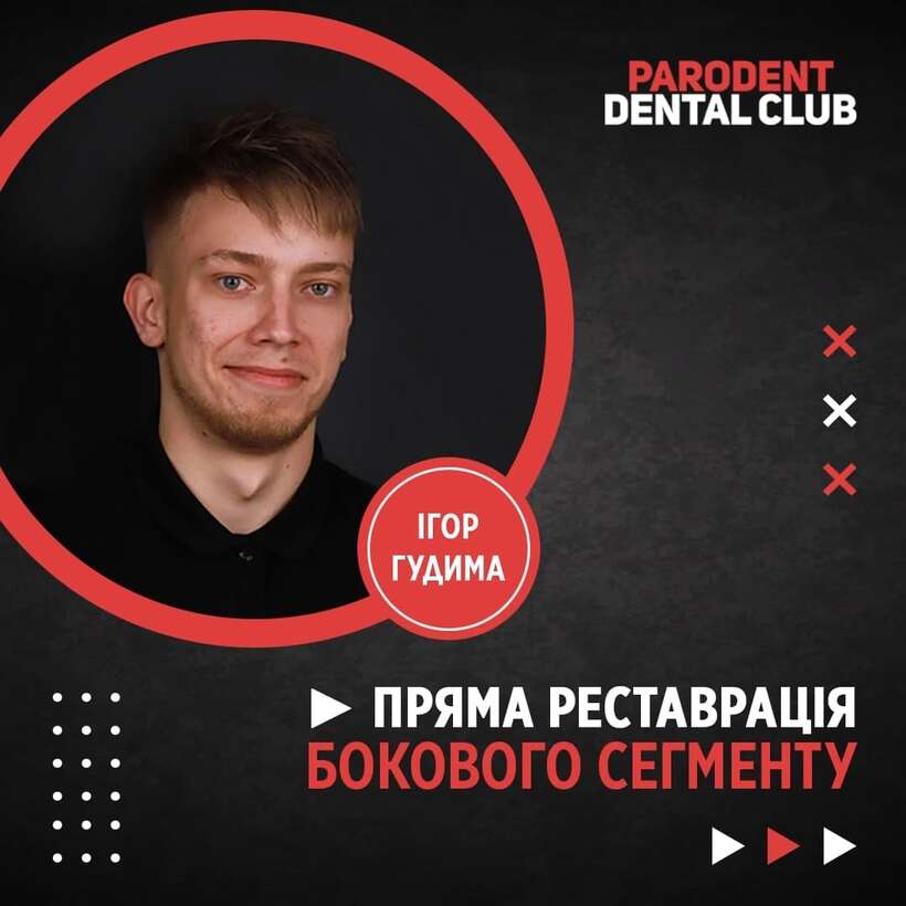 Художня реставрація бокової групи зубів Художня реставрація бокової групи зубів NaviStom