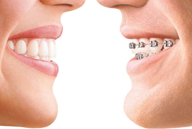 Індивідуальні практичні курси з ортодонтичної стоматології NaviStom
