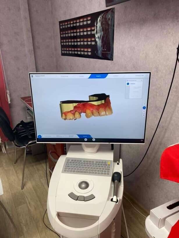Интраоральный сканер Cerec Omnicam AC Dentsply Sirona Интраоральный сканер Cerec Omnicam AC Dentsply Sirona NaviStom