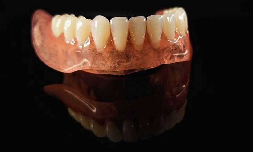 Інжекція та поліровка нейлонових протезів. NaviStom