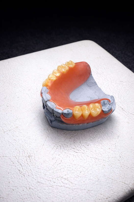 Інжекція та поліровка нейлонових протезів. NaviStom