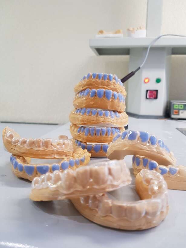 Изготовление индивиуальных кап NaviStom