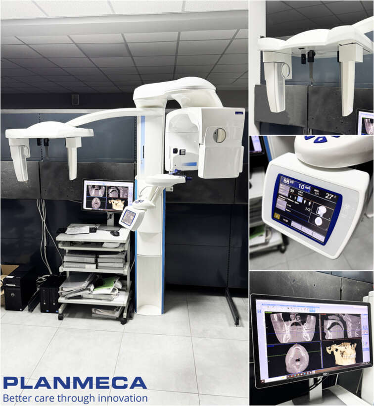 Комп`ютерний Томограф Planmeca ProMax3D Mid NaviStom