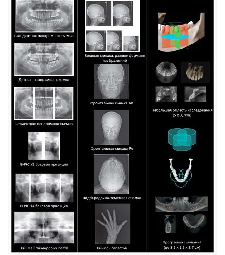 КТ KodakCS 9000 Carestream Dental NaviStom
