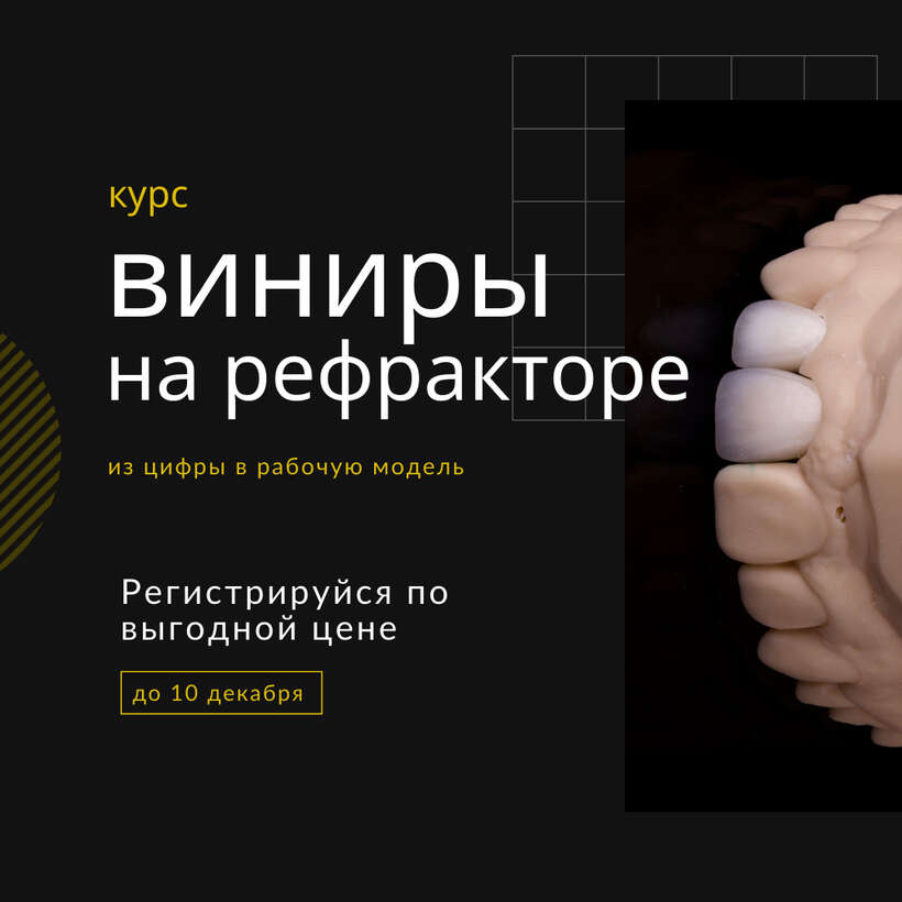 Курс для зубных техников `Виниры на рефракторе` NaviStom
