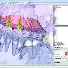 Onyx Ceph 2022 рік всі модулі Onyx Ceph 2022 рік всі модулі NaviStom