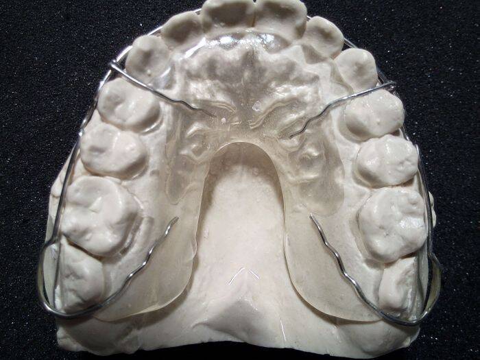 Ортодонтия. Изготовление ортодонтические аппаратов, Киев NaviStom