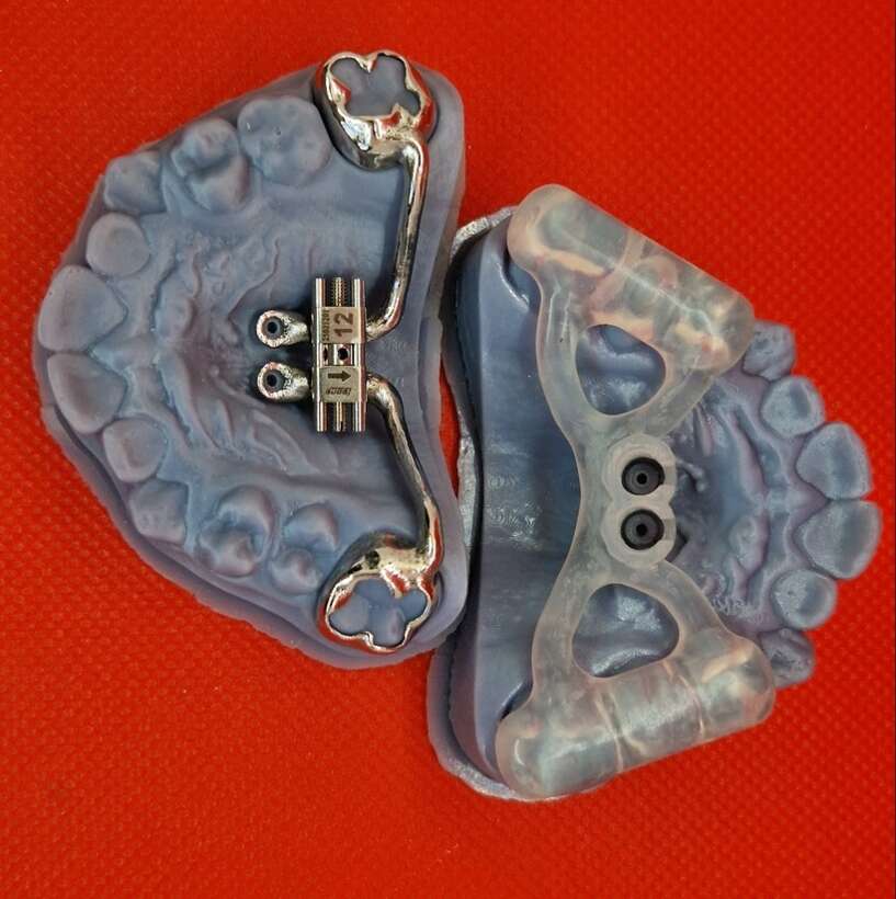 Ортодонтія. Працюємо з усією Україною. NaviStom