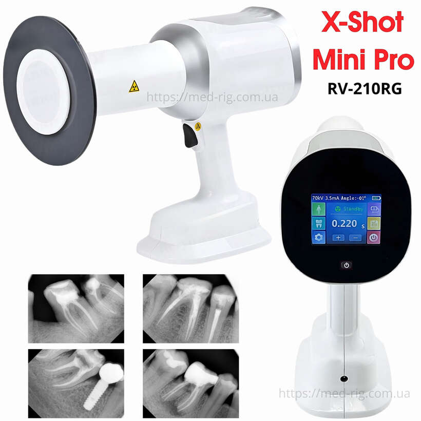 Портативний Стоматологічний Рентген Апарат X-Shot Mini Pro ТОК-3.5mА ! Сенсор! - Новинка 2025 Склад! NaviStom