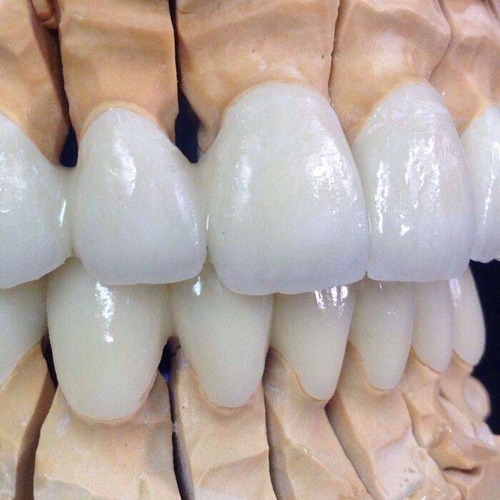 Предлагаем широкий спектр зуботехнических работ по `приятным ценам`, e-max - Zirconia Ceramic, Київ NaviStom