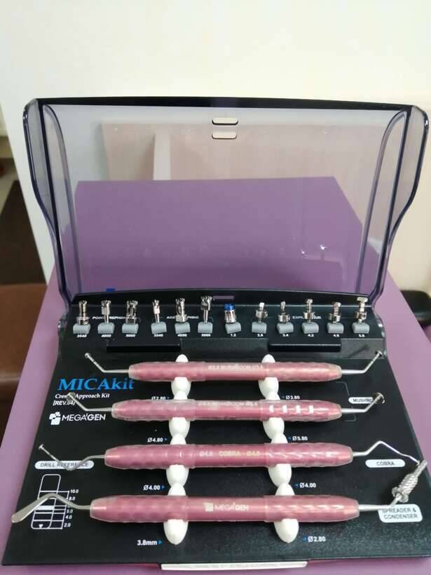 продам набір для закритого синус ліфтінга megagen NaviStom