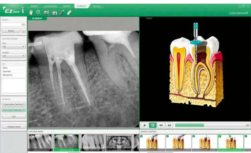 Програма для візіографів Vatech EzDent-i - Повна Версія 2024 - Підтримка WINDOWS 11 Програма для візіографів Vatech EzDent-i - Повна Версія 2024 - Підтримка WINDOWS 11 NaviStom