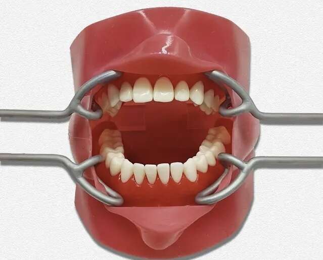 Ретрактори,ротозоширювачі для губ на складі! Висока якість,доступна ціна! NaviStom