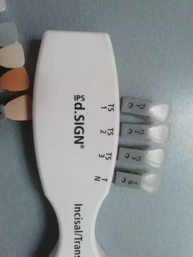 Розколірка Ivoclar vivadent NaviStom