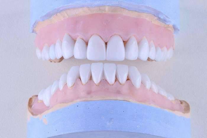 Широкий спектр зуботехнических работ, Вінниця NaviStom