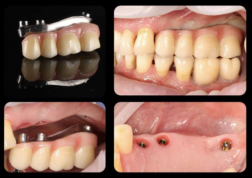 Шукаємо зубного техніка NaviStom