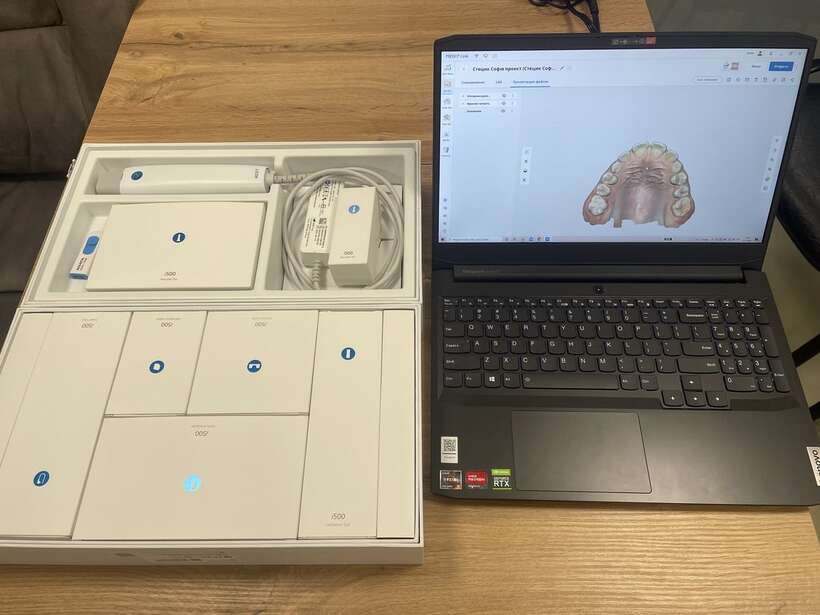 Сканер інтраоральний Medit i 500 + Ноутбук Lenovo Ryzen 5, RTX 3060,16 GB Сканер інтраоральний Medit i 500 + Ноутбук Lenovo Ryzen 5, RTX 3060,16 GB NaviStom