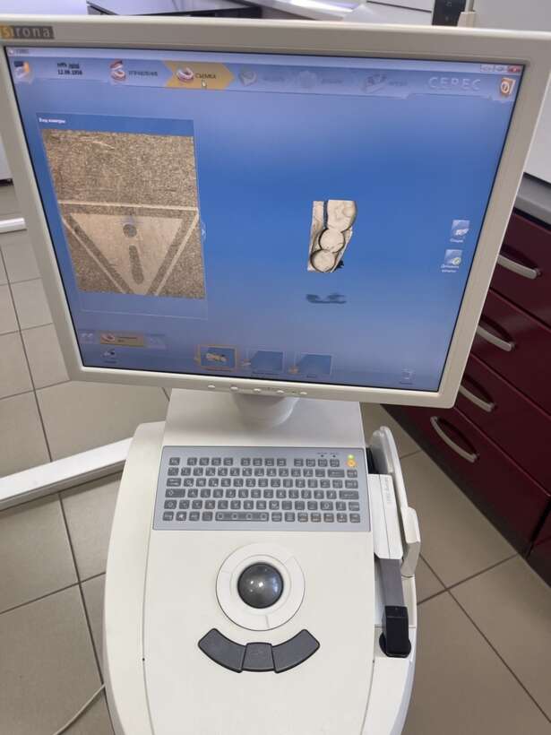 Сканер Sirona blucam NaviStom