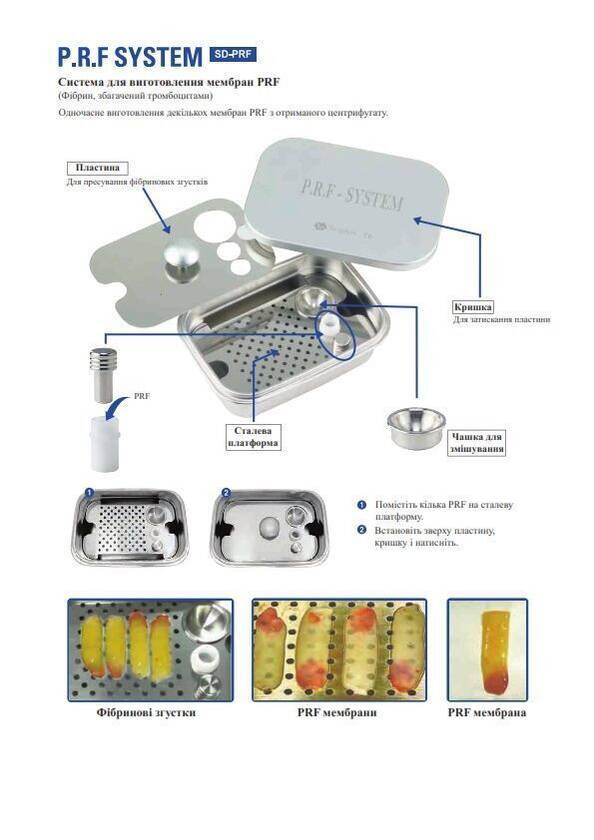 SURGIDENT P. R. F SYSTEM PRF NaviStom