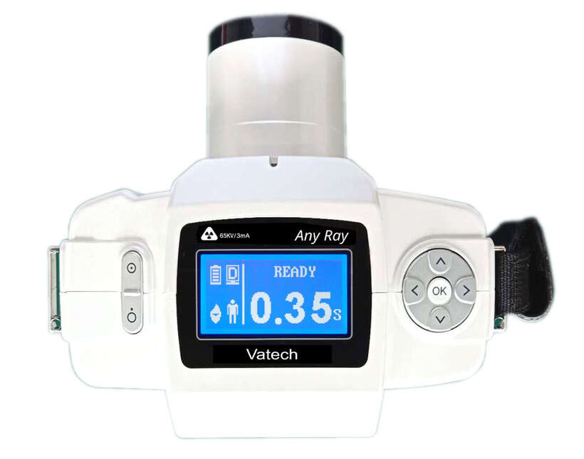 VATECH ANY RAY(ПІВДЕННА КОРЕЯ) ПОРТАТИВНИЙ РЕНТГЕН АПАРАТ НАЙПРОГРЕСИВНІШИЙ СЕРЕД `ФОТОРЕНТГЕНІВ` VATECH ANY RAY(ПІВДЕННА КОРЕЯ) ПОРТАТИВНИЙ РЕНТГЕН АПАРАТ НАЙПРОГРЕСИВНІШИЙ СЕРЕД `ФОТОРЕНТГЕНІВ` NaviStom