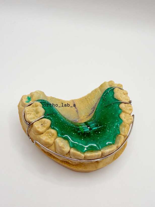 Виготовлення ортодонтичних апаратів та конструкцій NaviStom