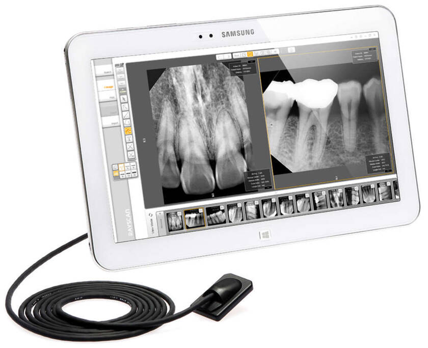 ВІЗІОГРАФ HD RIOSensor 2.2 МП RAYmedical (Корея) (стоматологічний підрозділ Samsung) СКЛАД NaviStom