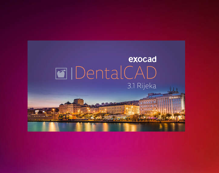 Встановлення Exocad 3.1 Rijeka (cracked) +ImplantModule +Full Library. Ціна 270$ NaviStom