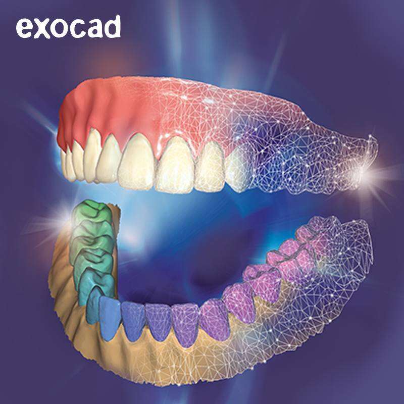 Встановлення ExoCad 3.2 Elefsina + бібліотеки імплантів NaviStom