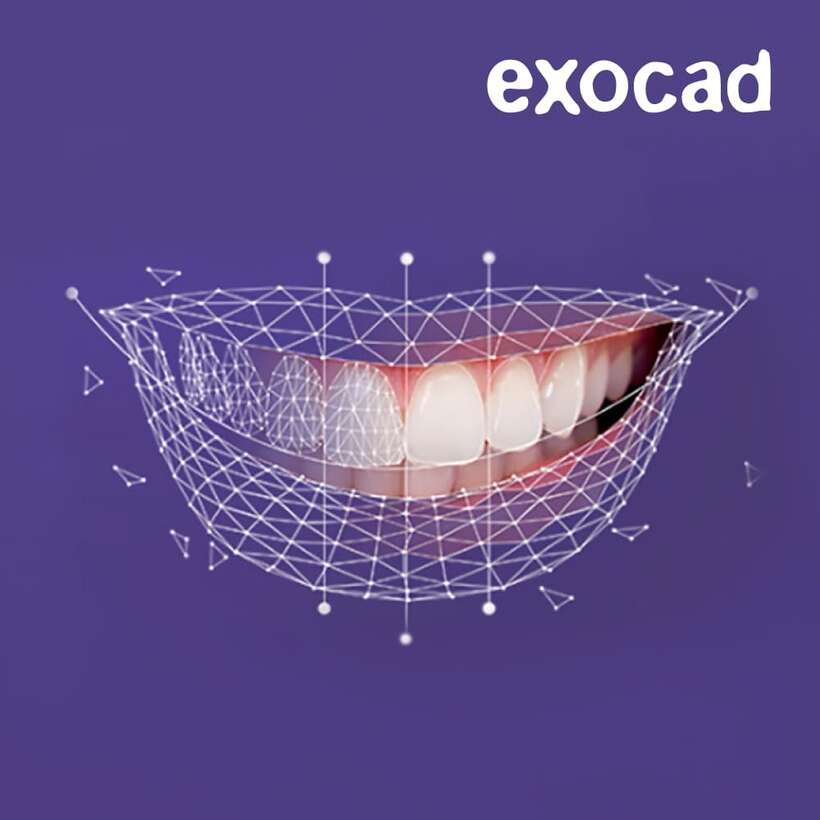 Встановлення ExoCAD 3.3 Build 9512, 2026 NaviStom