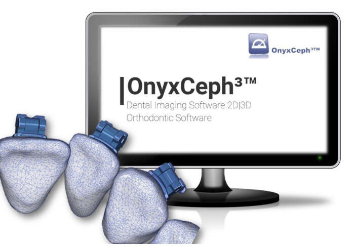 Встановлення OnyxCeph 2023 last build 211 Full EXOCADMASTER NaviStom