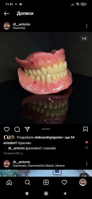 Знімне протезування. Запрошую до співпраці лікарів і техніків NaviStom