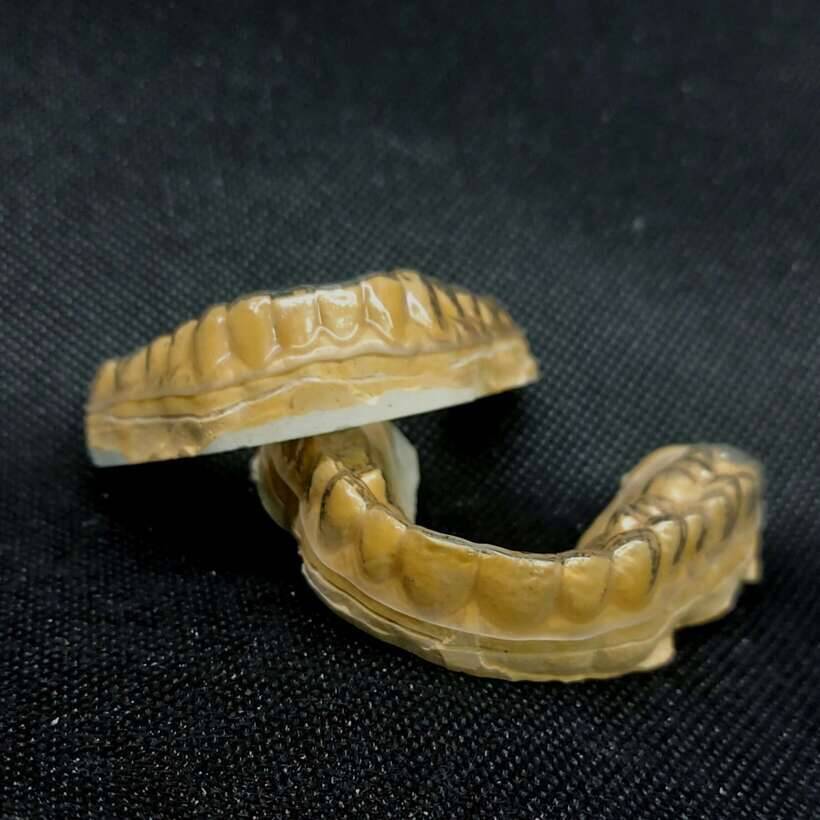 Зубний технік. Зуботехнічні послуги. Виготовлення індивідуальних кап. Зубний технік. Зуботехнічні послуги. Виготовлення індивідуальних кап. NaviStom