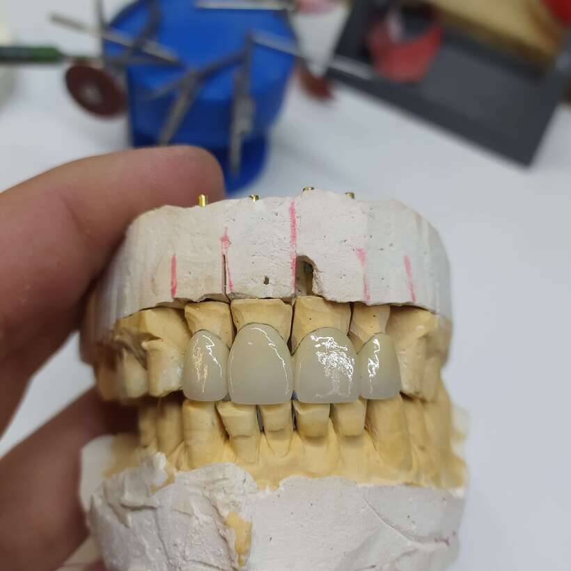 Зубной Техник. Керамист. Зуботехническая Лаборатория. Протезист. NaviStom