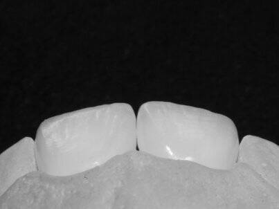 Зубной техник предлагает сотрудничество стоматологам-ортопедам, Краматорськ NaviStom