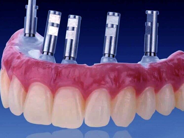 Зуботехническая лаборатория с мировым именем, Київ NaviStom