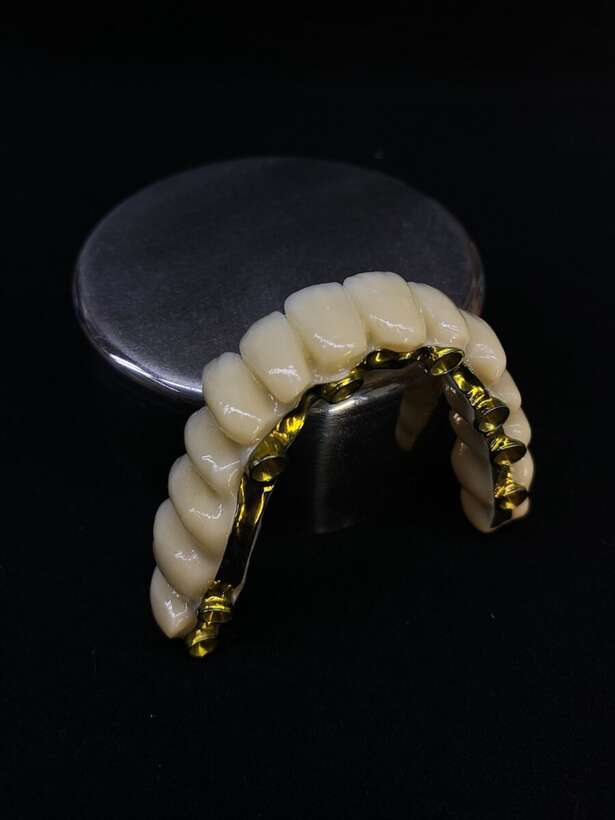 Приглашает к сотрудничесту зуботехническая лаборатория `TeethArt` CAD CAM, Zircon, PMMA Прайс в л.с. NaviStom
