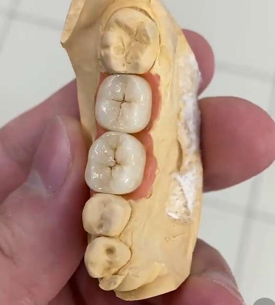 Зуботехнічна лабораторія Deliani Dent, виготовлення всіх видів ортопедії (оснащенна генераторами!) NaviStom