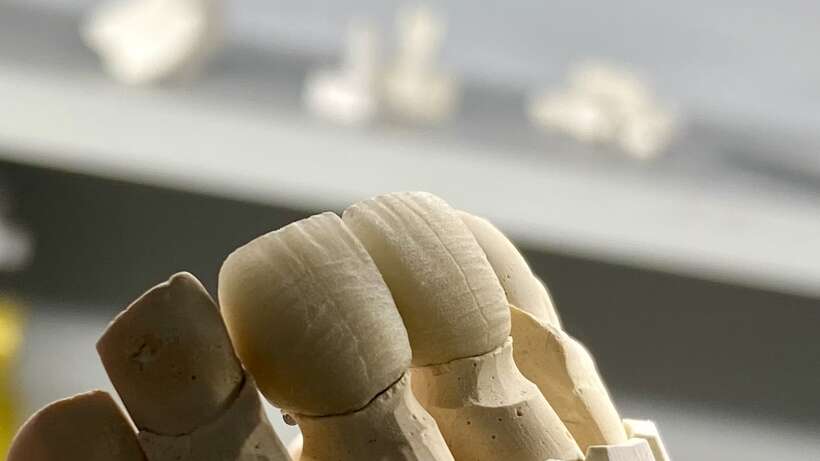 Зуботехнічна лабораторія `Elion`якість у кожному етапі! NaviStom