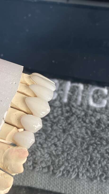 Зуботехнічна лабораторія `Elion`якість у кожному етапі! NaviStom